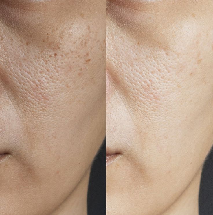 WhatsApp Image 2026-01-25 at 11.48.41 PM